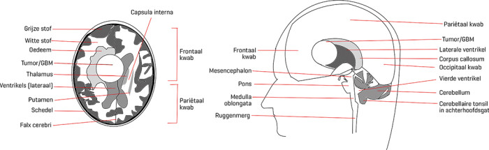 Schematische weergave van de hersenen.