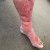 Rood en gezwollen been