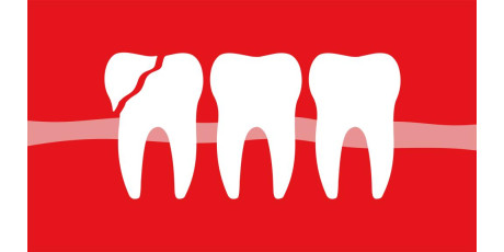 Illustratie van tanden