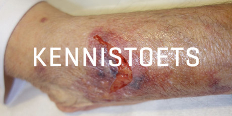 Scheurwond kennistoets
