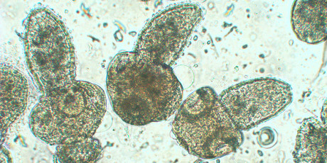 Microbiologische diagnostisch onderzoek