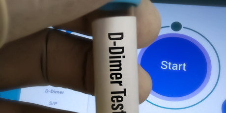 D-dimeertest