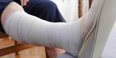De herziene NHG-Standaard Ulcus cruris venosum legt meer nadruk op behandeling van de onderliggende oorzaak door de inzet van compressietherapie. Foto: Shutterstock