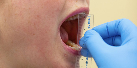 Temporomandibulaire disfunctie.