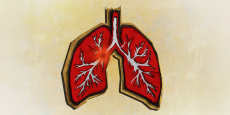 Het YEARS-algoritme maakt diagnostiek longembolie eenvoudiger en efficiënter. Foto: Getty images/Unsplash