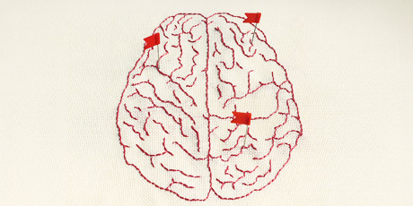parkinsonism_800_x_400_v1.jpg