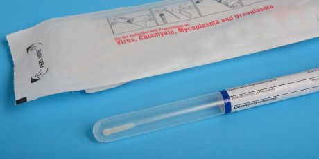 Ruim de helft van de jongeren kiest de huisarts voor een chlamydiatest als asymptomatisch testen bij CSG wegvalt. Foto: Shutterstock