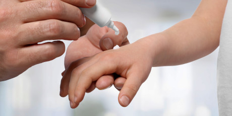 Bij overdosering van lokale anesthetica kan Lokale Anestheticum Systemische Toxiciteit (LAST) ontstaan. Foto: Shutterstock