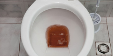 Colakleurige urine