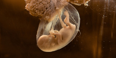 Afbeelding van foetus