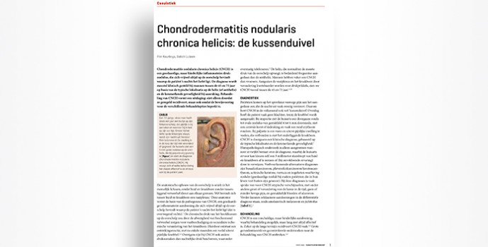 Reactie ‘Chondrodermatitis nodularis chronica helicis’