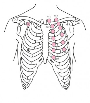 Acupunctuurpunten waarbij het risico op beschadiging van de longen verhoogd is, zijn gerelateerd aan de maag (S11-17), de nier (K22-27) en de long (L2)