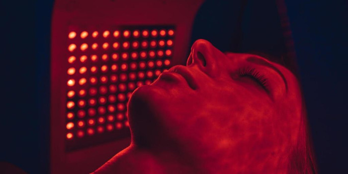 H&W Huidtherapie bij Acne