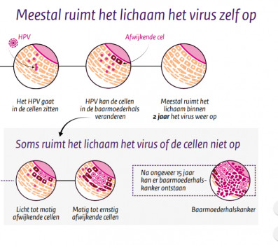 HPV-infectie